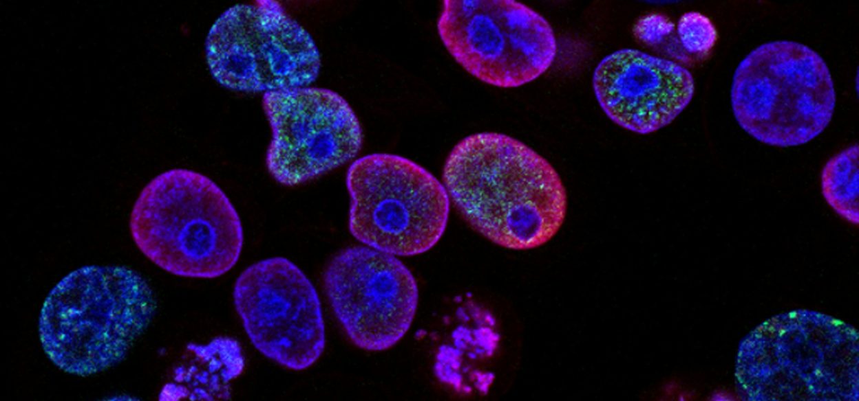 national-cancer-institute-L7en7Lb-Ovc-unsplash